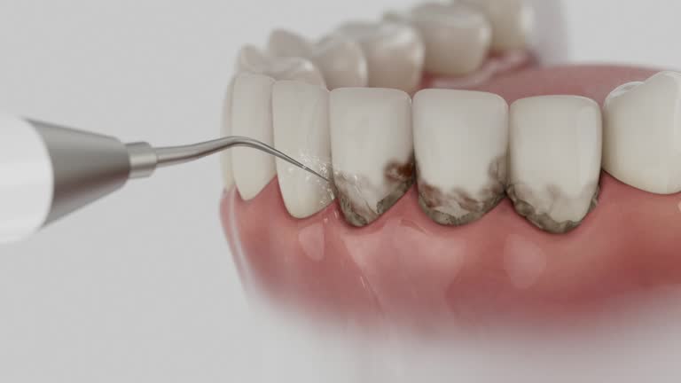 Trusted Root Canal Treatment service in Clearfield, PA - Dentist Open Now
